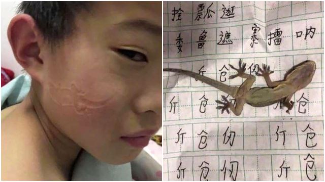 kid-slept-on-lizard-cicak-face-imprint-funny-viral-1.jpg