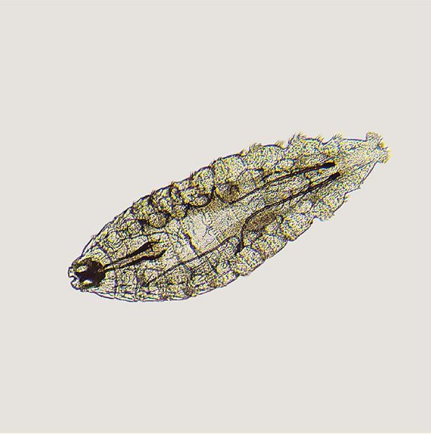 rasa gatal rupanya ada lebih sedozen ulat dalam mata lelaki ini