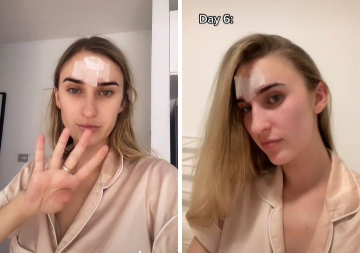 kini trend wanita lekat soletip pada dahi elak kedutan