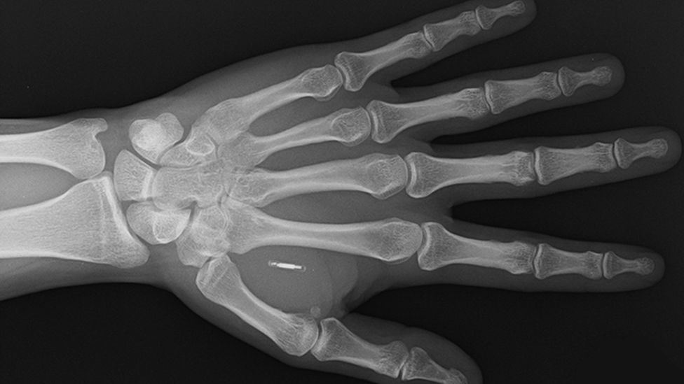 forget your cards & phones, this company builds microchip implants so that you can pay with your hands
