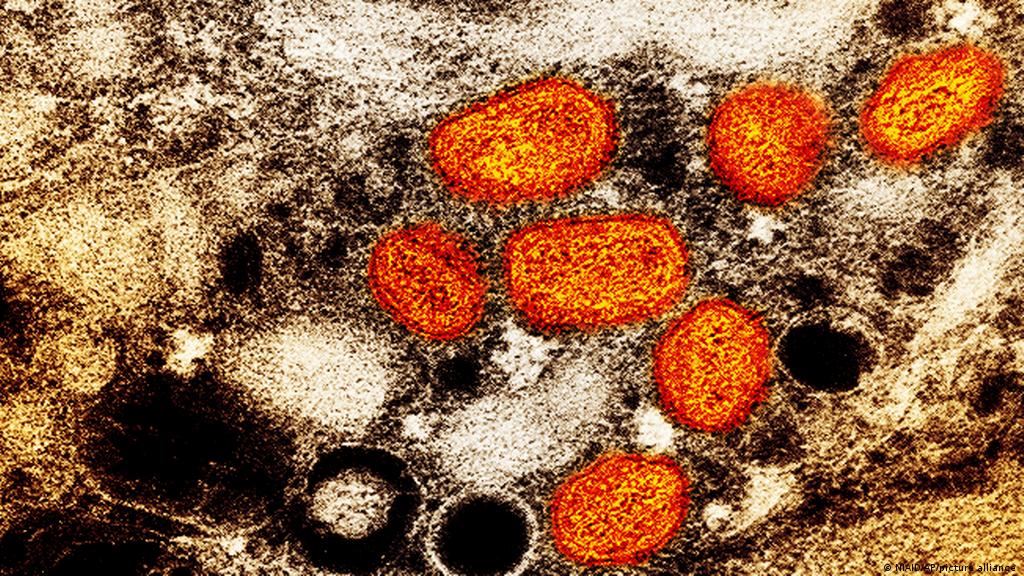 india catat kematian pertama cacar monyet di asia