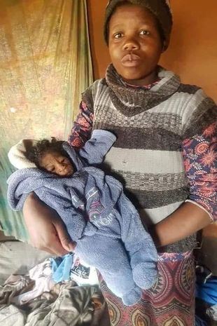 ibu muda terkejut lepas lahirkan bayi berwajah tua