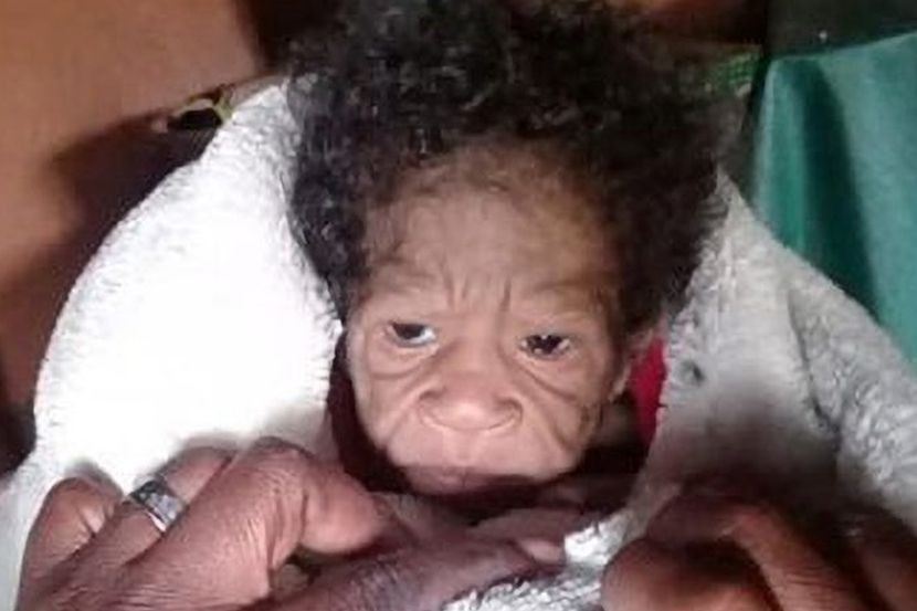 ibu muda terkejut lepas lahirkan bayi berwajah tua