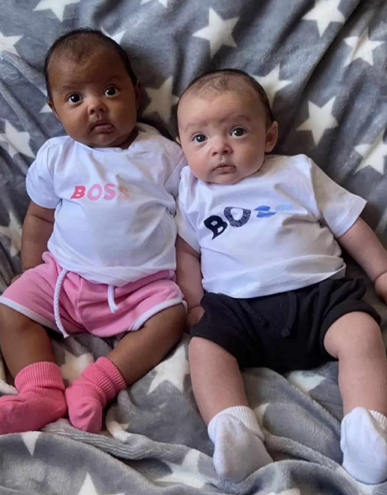 ibu terkejut lahir anak kembar tapi beza warna kulit