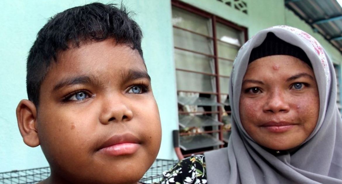 11-year-old orang asli boy captivates m’sians with his stunning blue eyes!