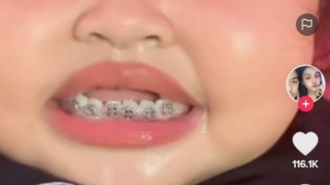 video anak kecil pakai pendakap gigi ini undang kecaman ramai