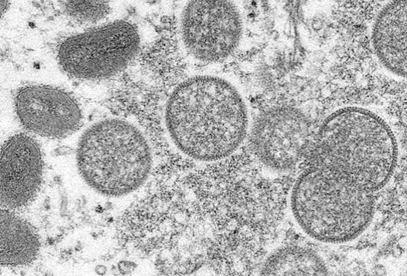 who lapor kes cacar monyet meningkat tiga kali ganda