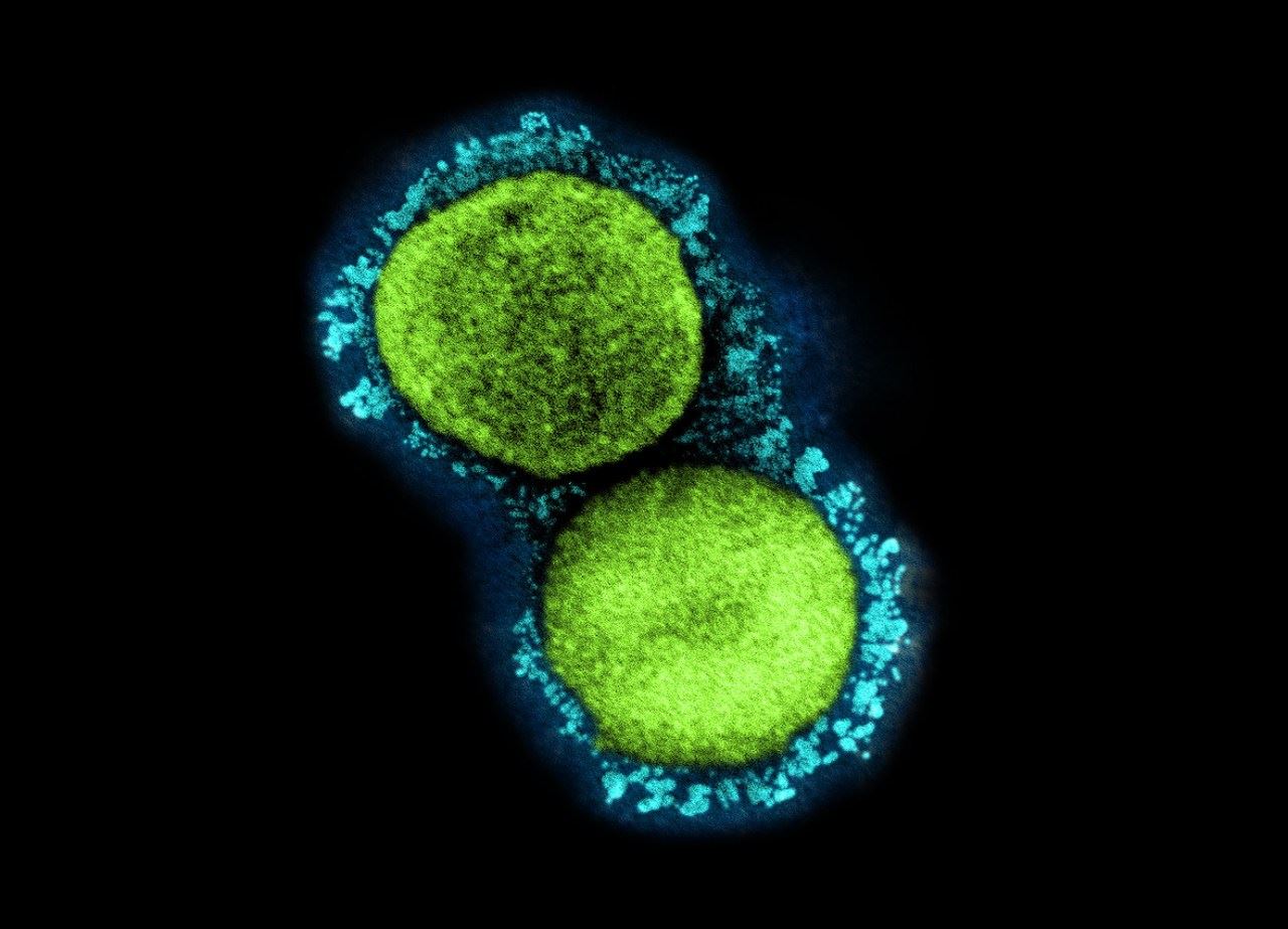 singapura jangka gelombang baru omicron pada julai atau ogos