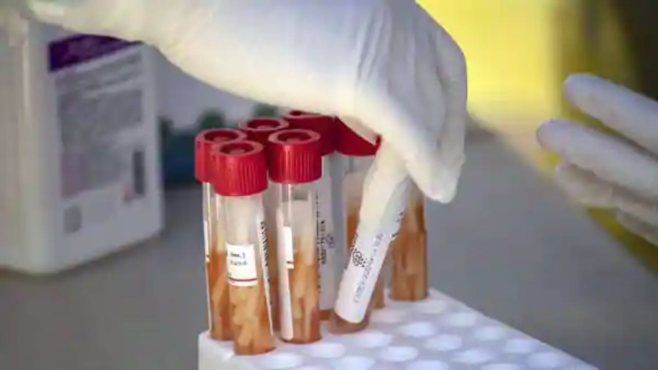 subvarian ba.5 omicron dijangka akan merebak lebih pantas 