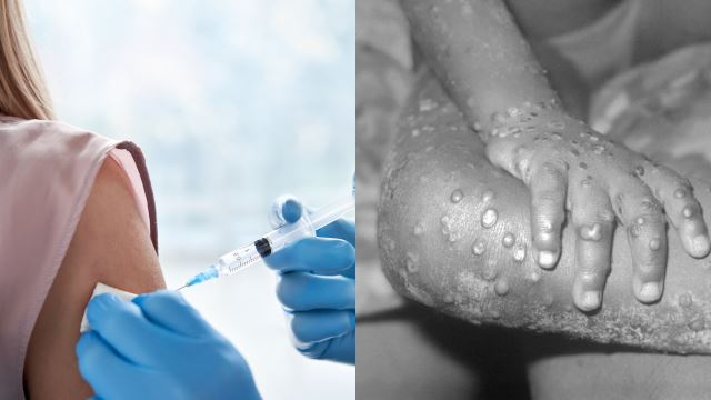 monkey-pox-vaccine-640.png