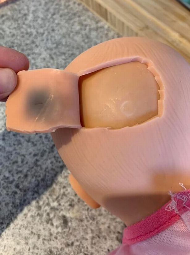 ibu risau tanda hitam pada anak patung ini makin lama makin besar