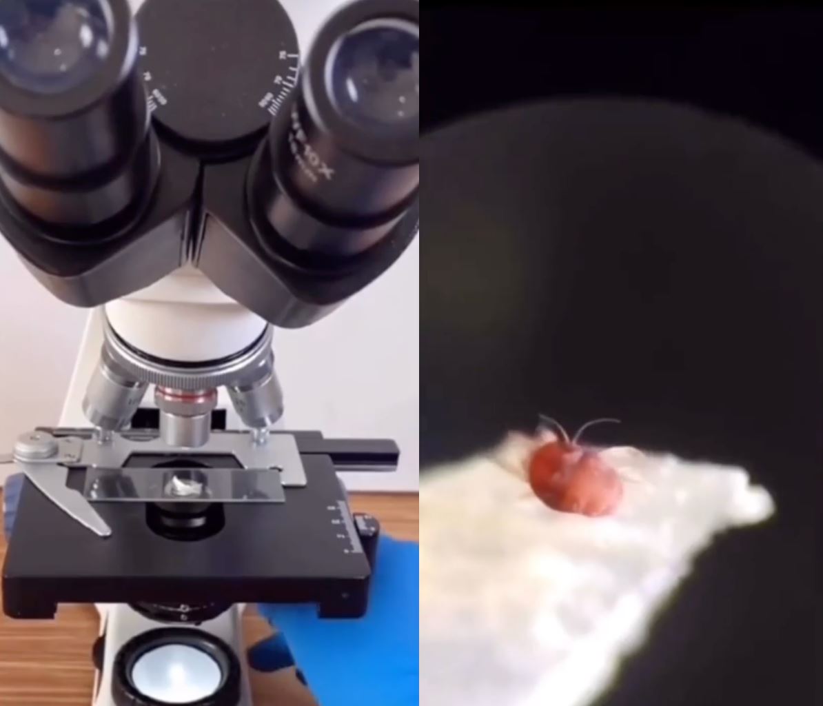 ini sebab kenapa kita jangan gigit kuku, tak sangka ada 'benda' ni