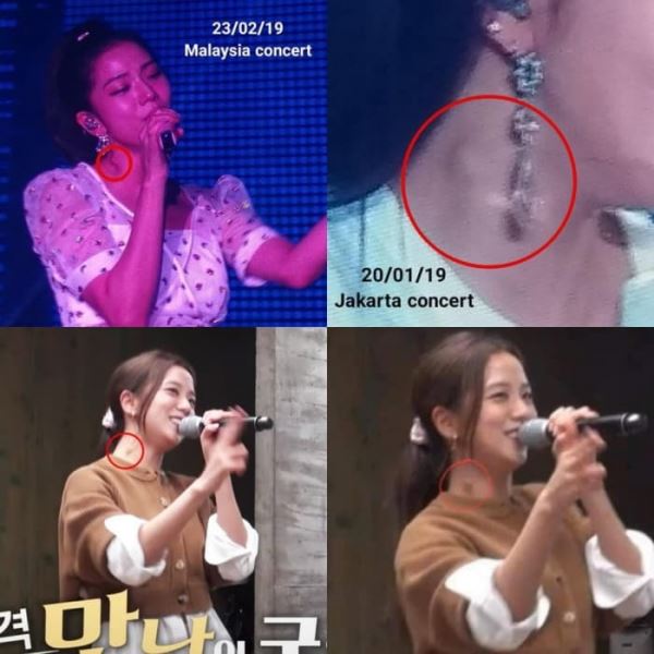 peminat risau lihat benjolan pada leher jisoo blackpink