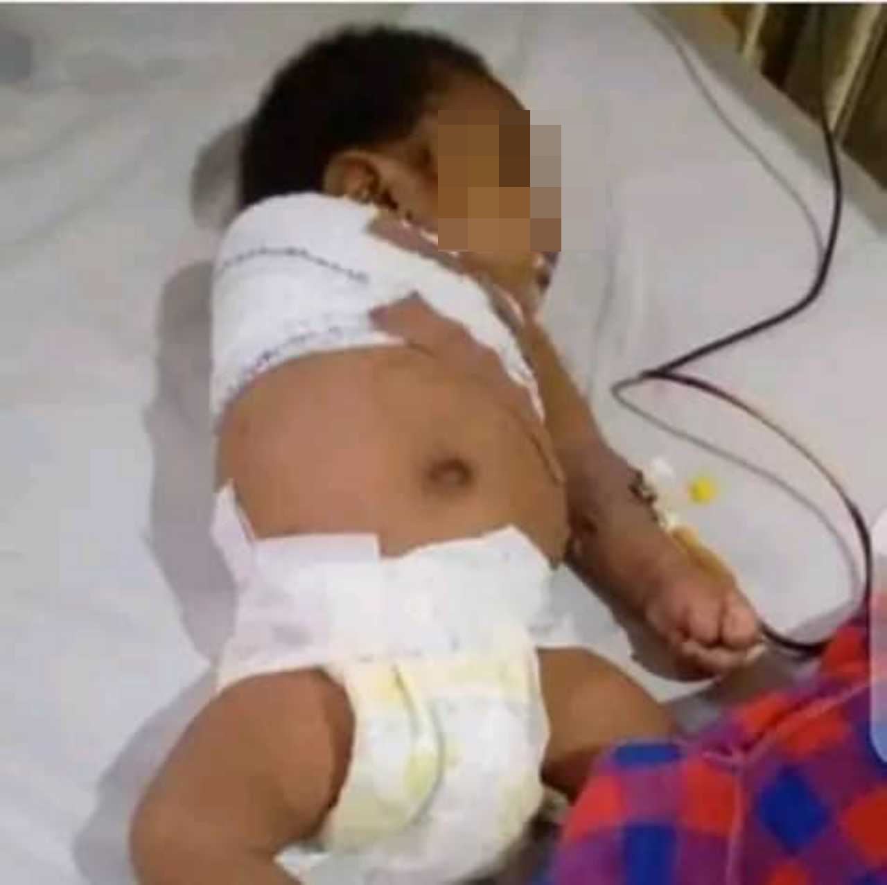 tak tahan dengar anak nangis masa tidur, bapa pukul lengan sampai kena potong