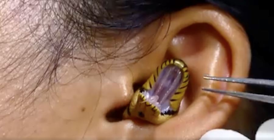 ular tersekat dalam lubang telinga wanita ini undang tanda tanya