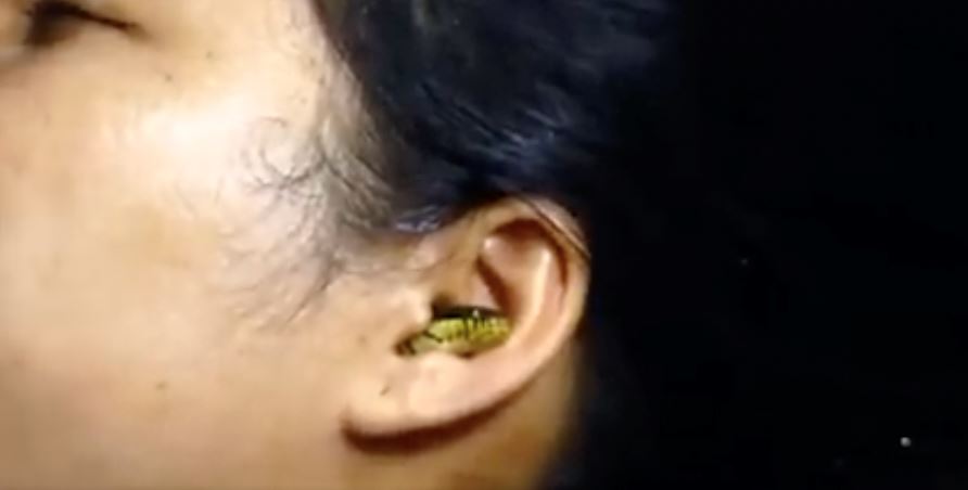 ular tersekat dalam lubang telinga wanita ini undang tanda tanya