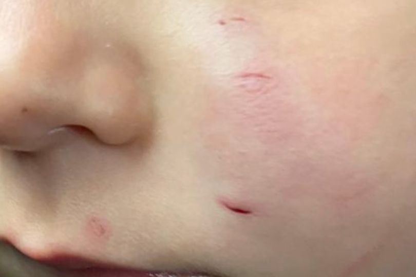 ibu trauma, anak dua tahun diserang tikus masa tidur