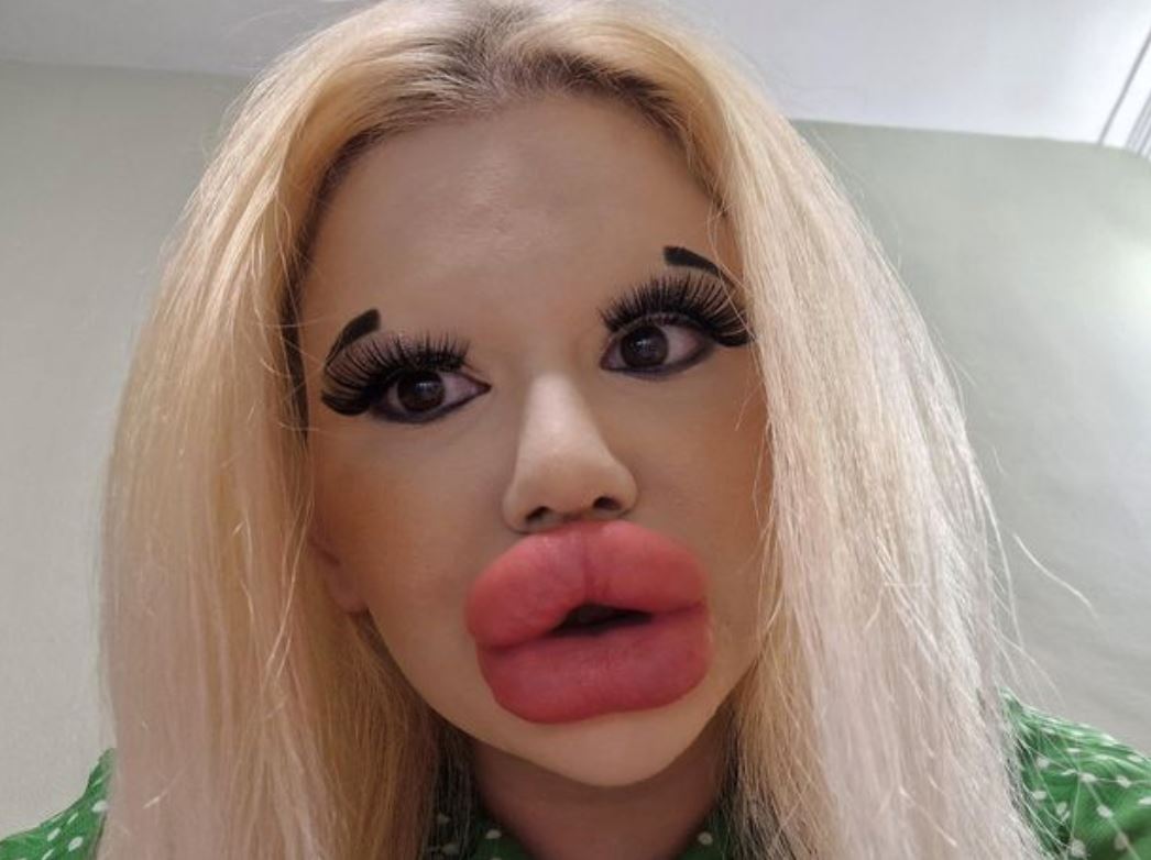 wanita bibir paling besar di dunia akui sukar cari pasangan