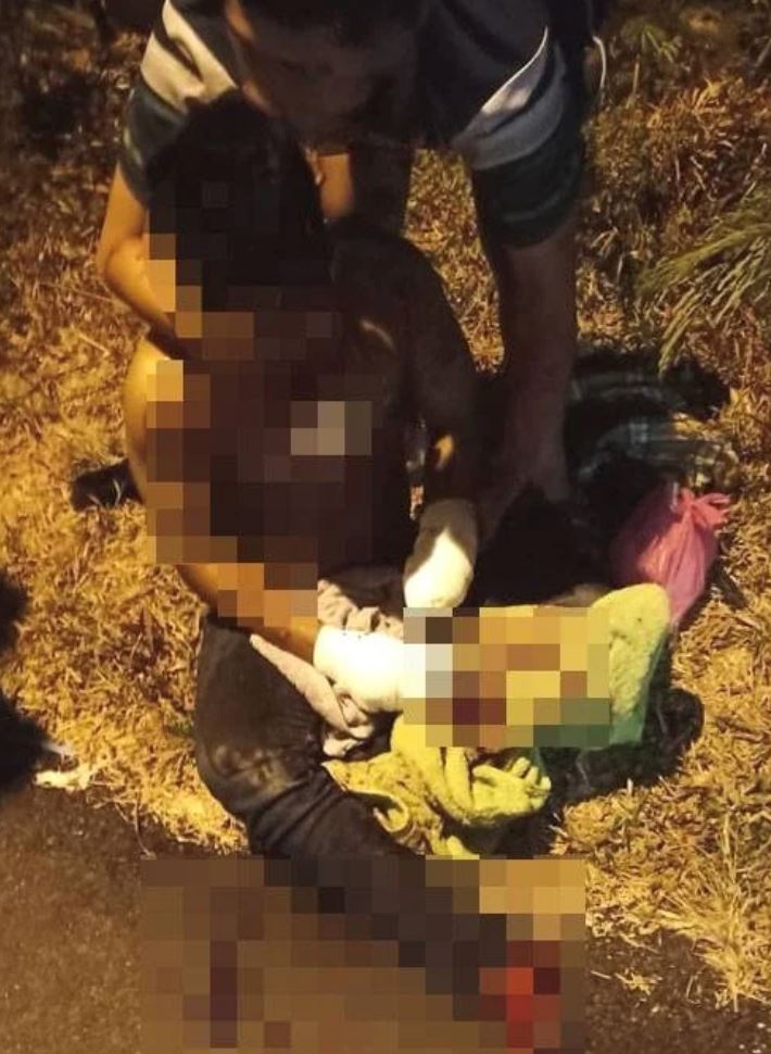 lelaki di terengganu putus tangan akibat terkena mercun buatan sendiri!