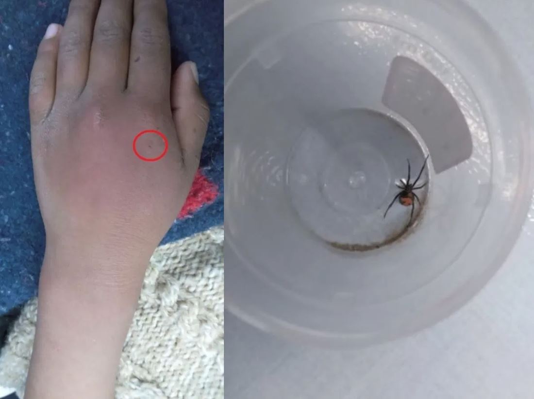 nak sangat jadi spider-man, budak biar diri digigit labah-labah masuk hospital