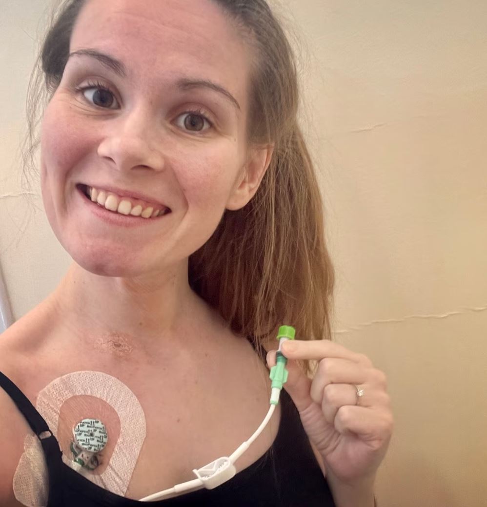 wanita derita tiga tahun tak boleh kencing gara-gara long covid