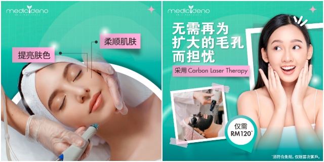 MedicDeno Carbon Laser Therapy海报3