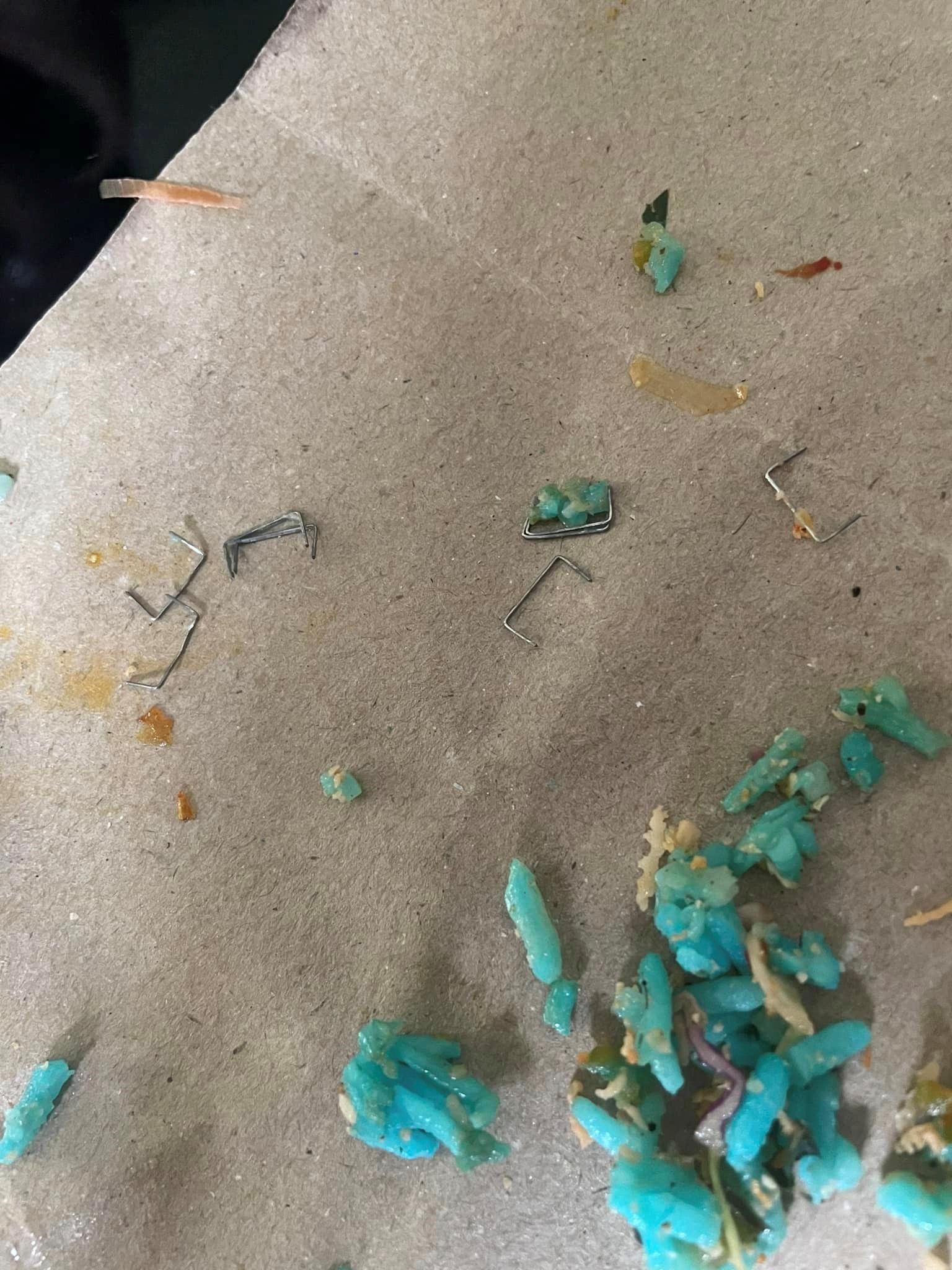 “thought it was bones!” woman shocked to find 10 pieces of staples in her nasi kerabu