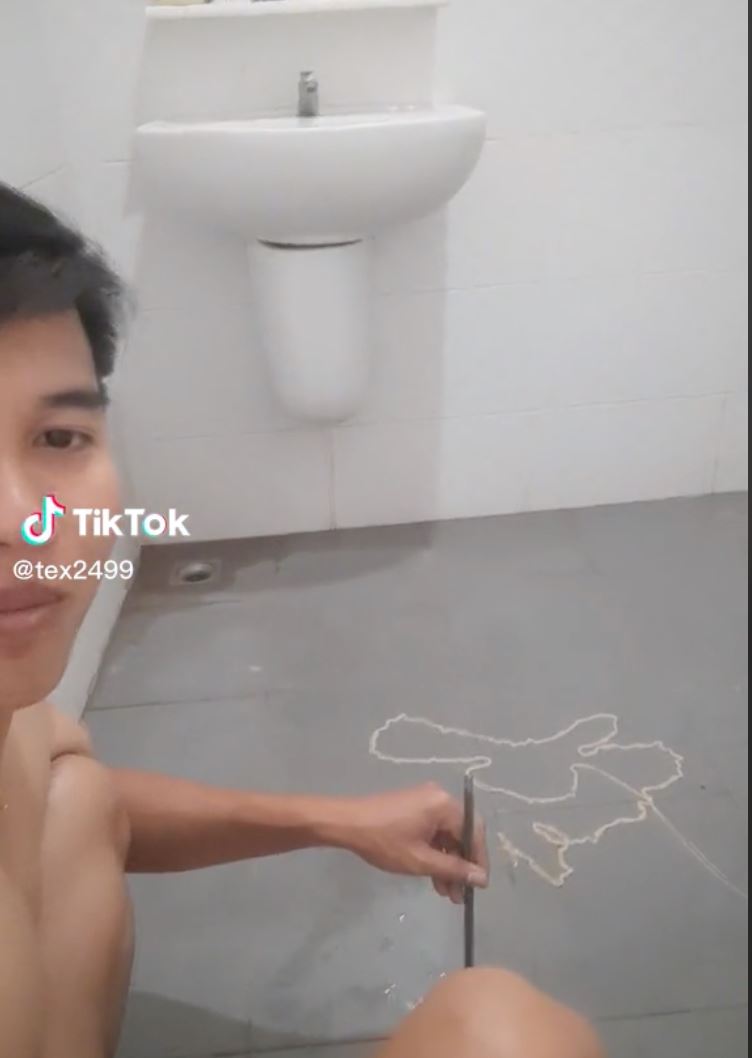 cacing pita panjang 2 meter keluar dari badan lelaki ini [video]