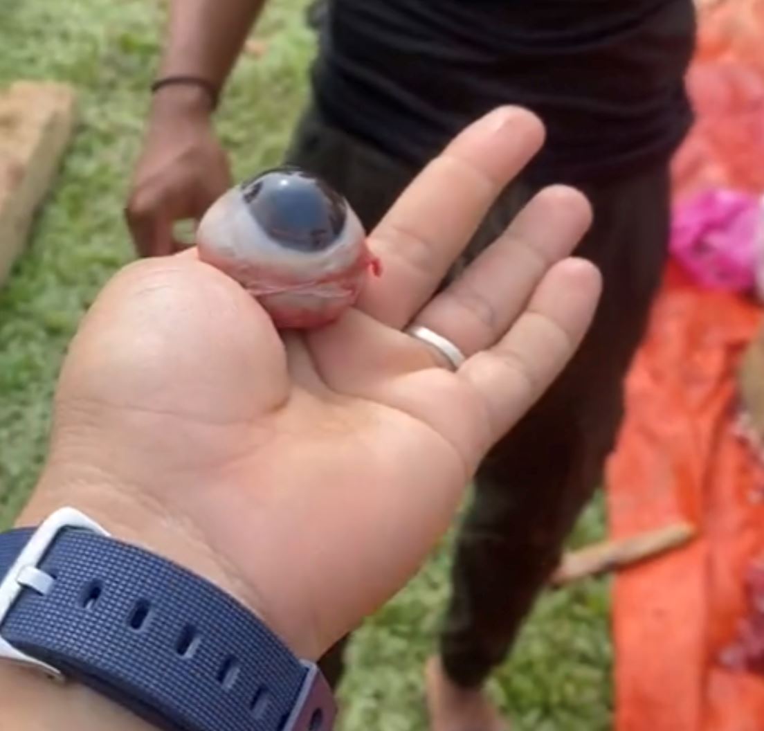 tular trend makan mata lembu mentah, tapi tiada bukti ia boleh merawat penyakit