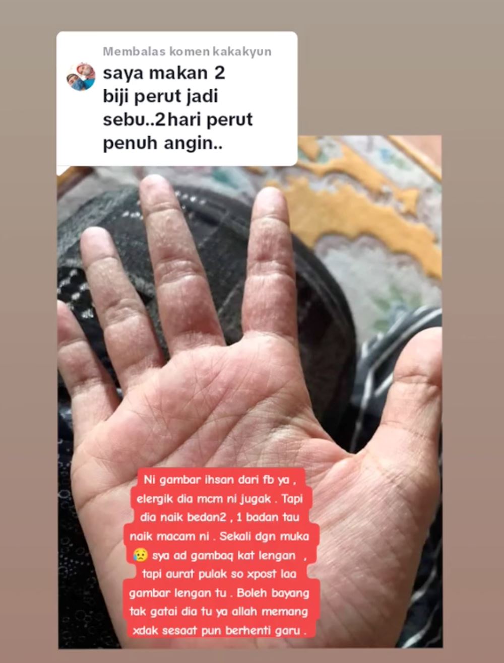 wanita ini hampir hilang nyawa lepas makan donut peach viral