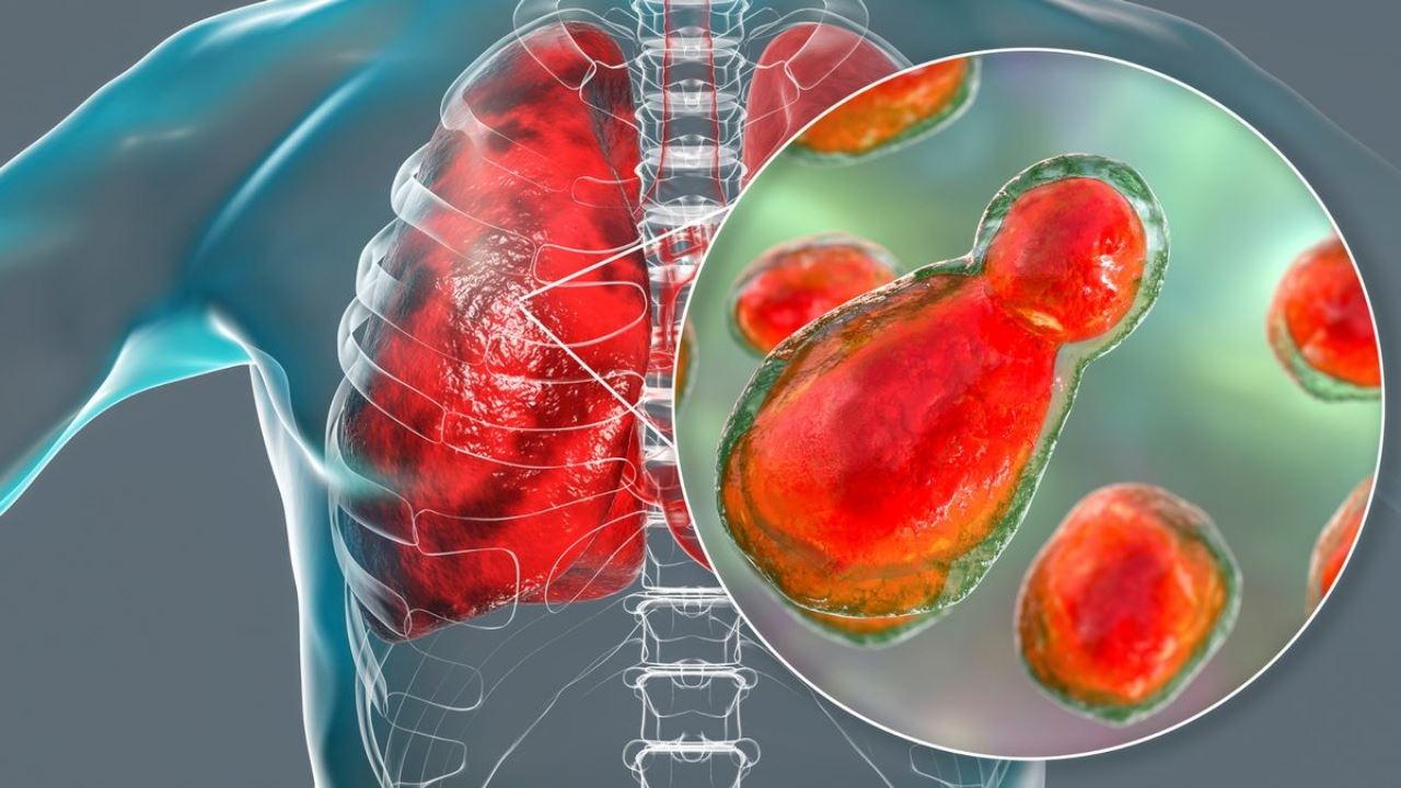 dua maut, as beri amaran wabak jangkitan kulat akibat ‘plastic surgery’
