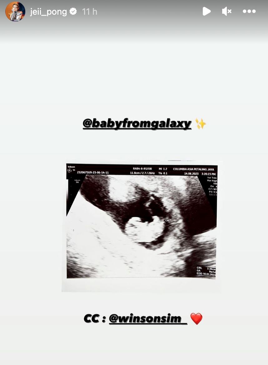 这次是真的！je庞琂予官宣怀孕了！