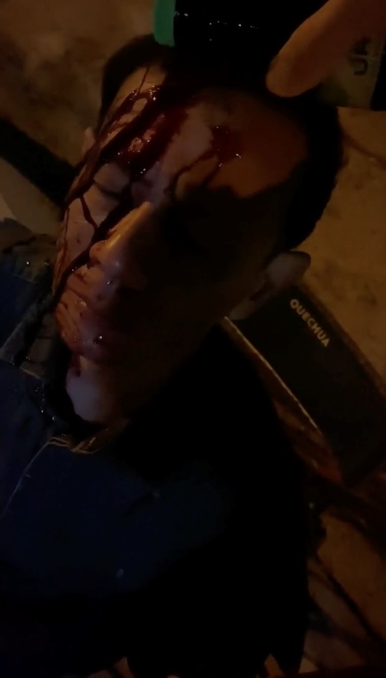 azhar sulaiman kongsi video berlumuran darah, warganet fikir ending projek: high council sedih