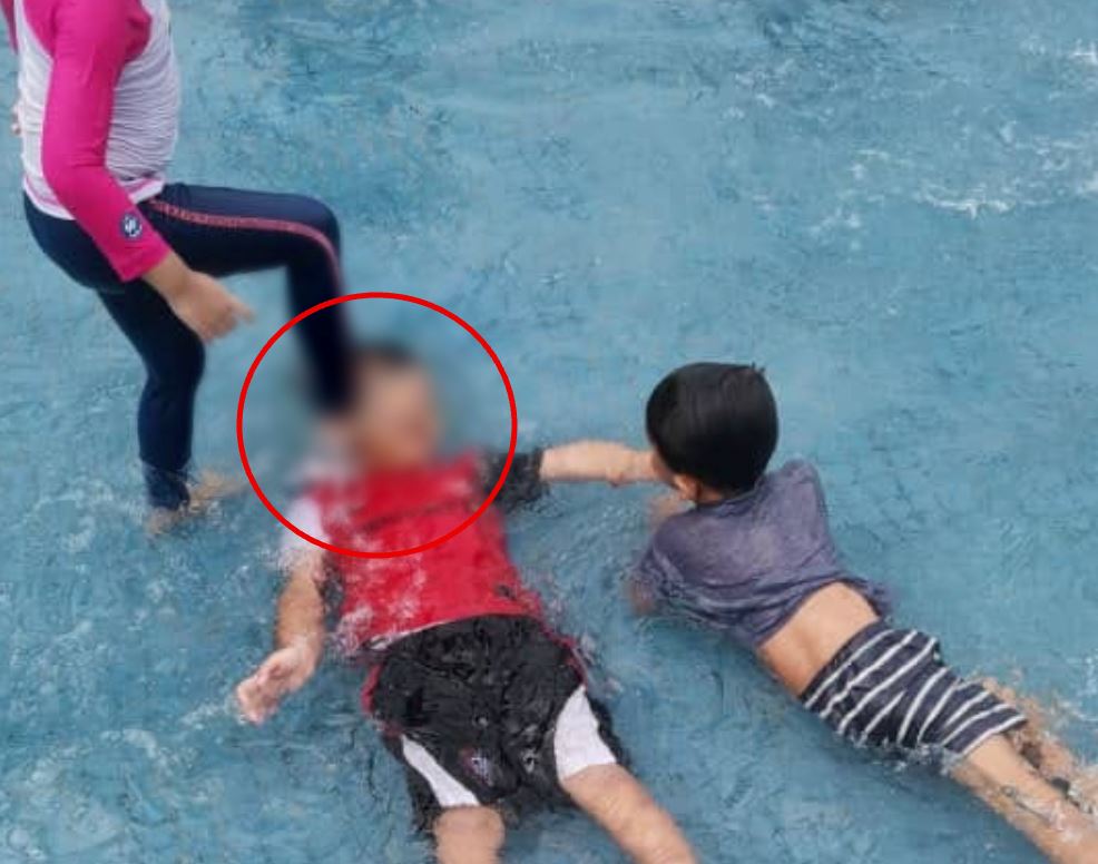 m’sian mother urges parents to watch their kids after child stepped on her son’s face at public pool