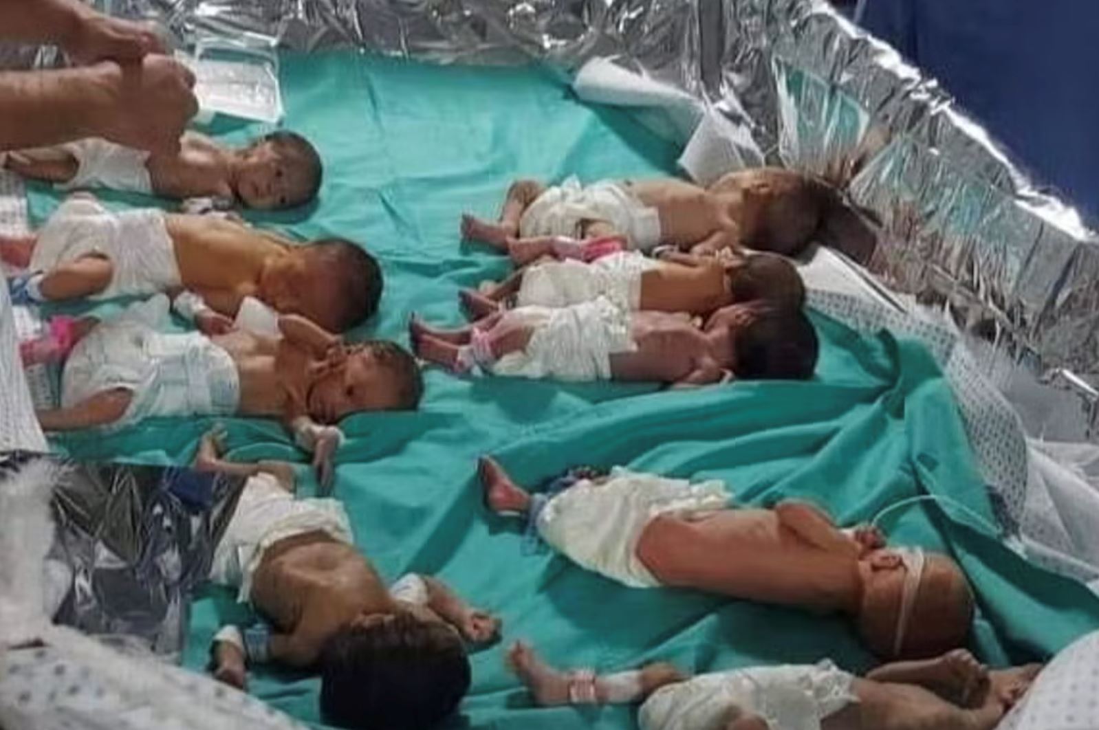 doktor di hospital gaza terpaksa balut bayi pramatang guna aluminium foil