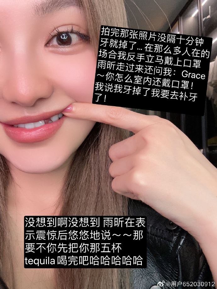 🦷周扬青吃掉一颗牙❗好友刘雨昕知道了还让她先把酒喝完🤣