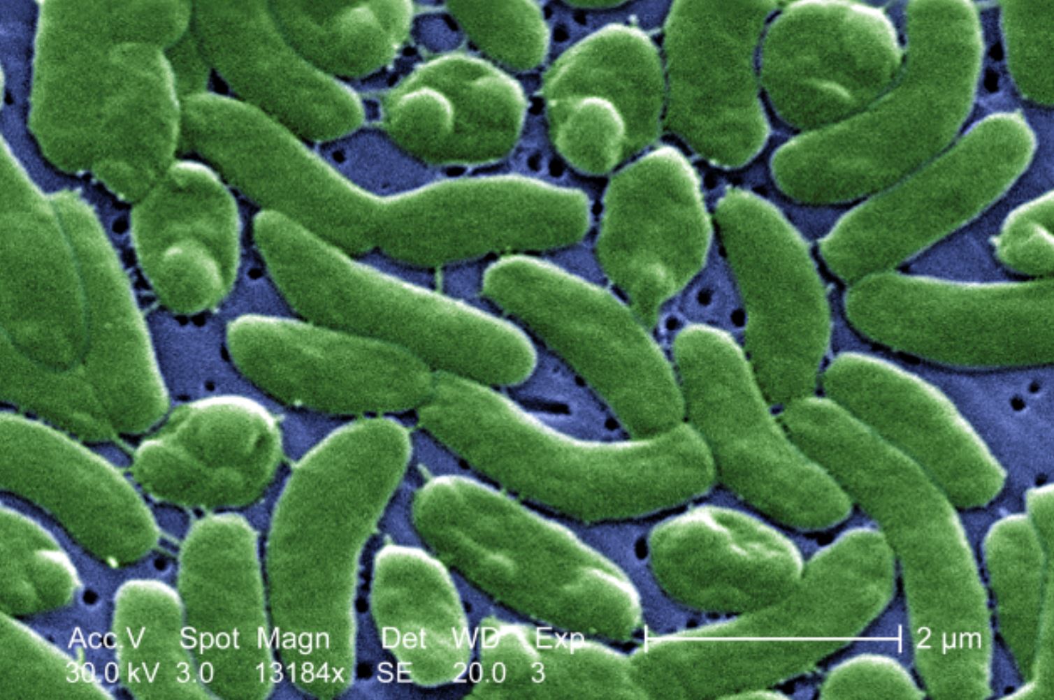 lelaki 30-an maut lepas makan tiram mentah tercemar dengan bakteria