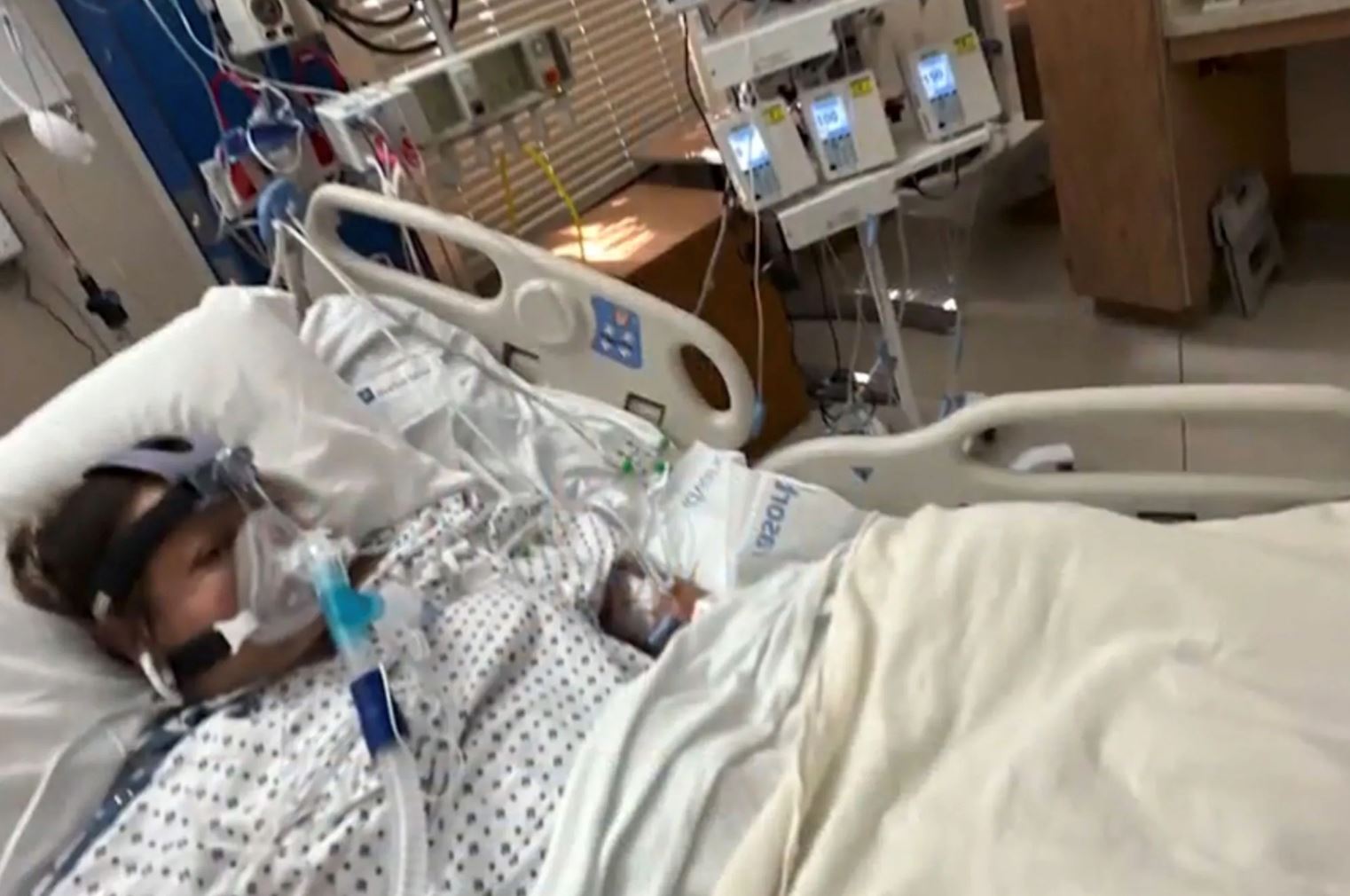 tangan, kaki terpaksa dipotong akibat makan ikan talapia tercemar