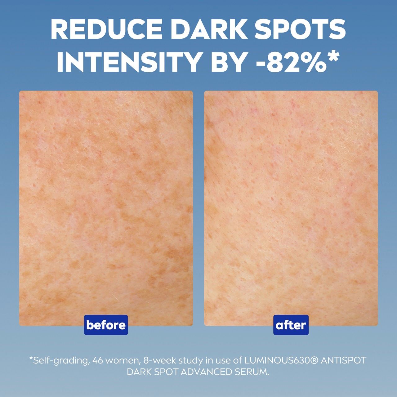 Nivea Thiamidol对肌肤的功效