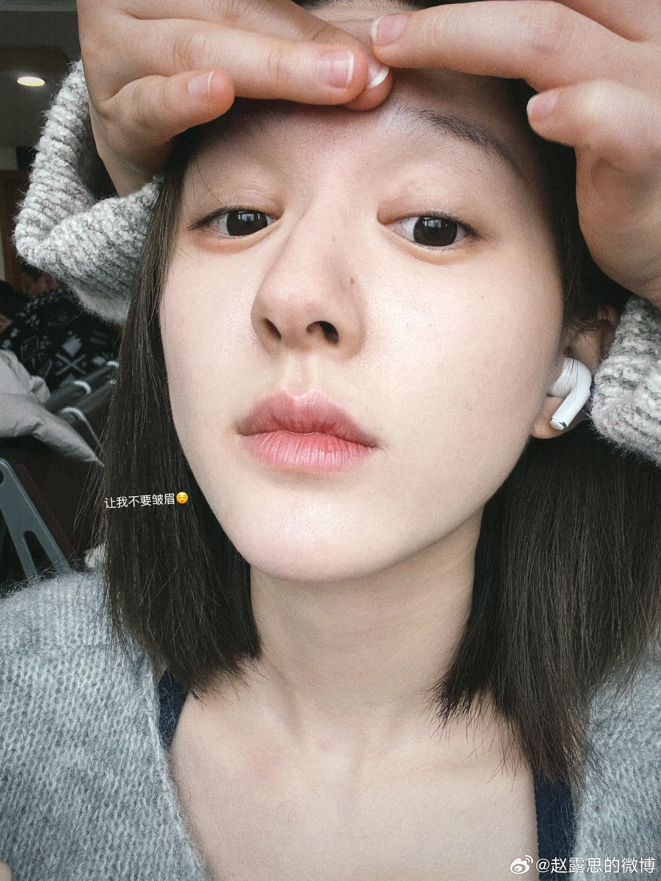 抑郁症5个躯体化症状❗赵露思：重视心理治疗很重要⚠️