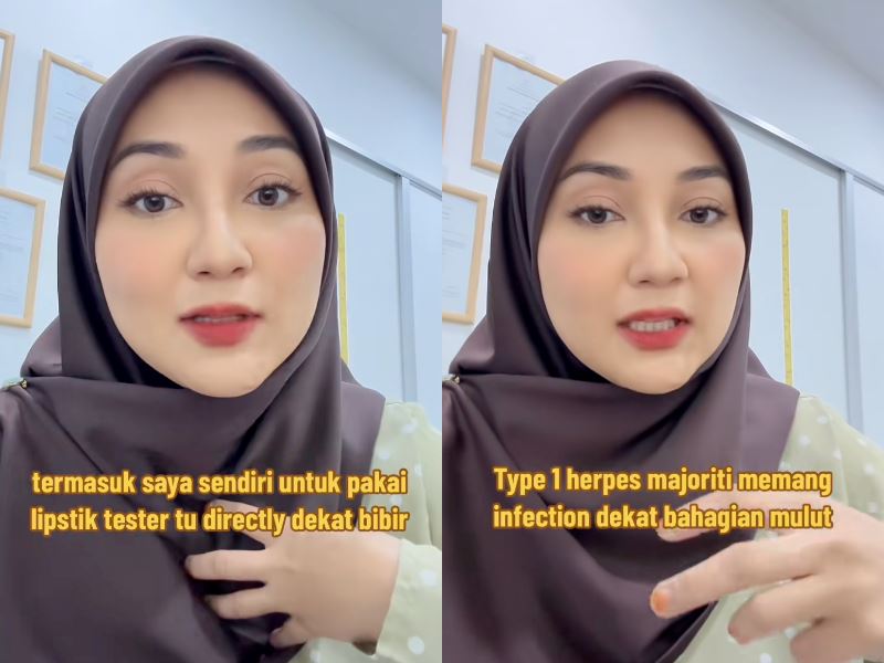 “herpes can be contracted without sexual contact” m’sian doctor issues lipstick tester warning