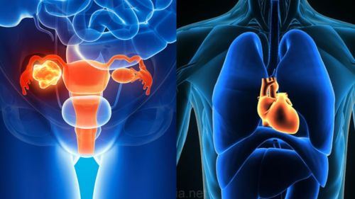 senarai 5 kanser paling agresif yang ramai tak sedar, ada yang merebak dalam masa singkat!