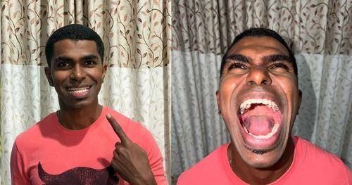 luar biasa! lelaki malaysia jadi pemegang rekod dunia dengan 42 batang gigi dalam mulut